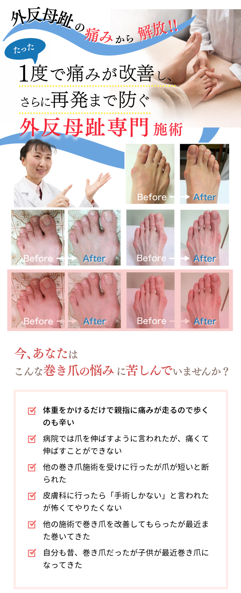 外反母趾専門 1度で痛み改善・再発予防